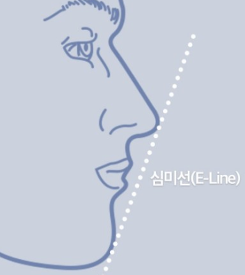 세라믹치과 돌출입교정 투명교정기로 ~ 관련 이미지 6