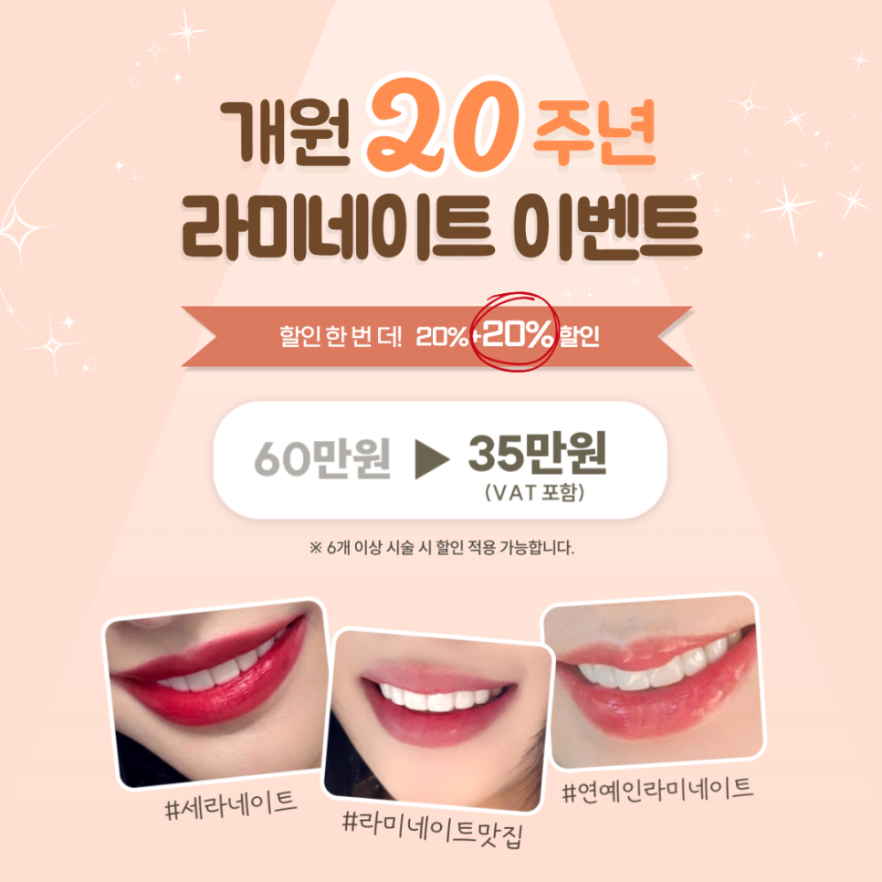 💛학동역 세라믹치과 20주년 이벤트💛 라미네이트, 충치치료 특가 관련 이미지 1