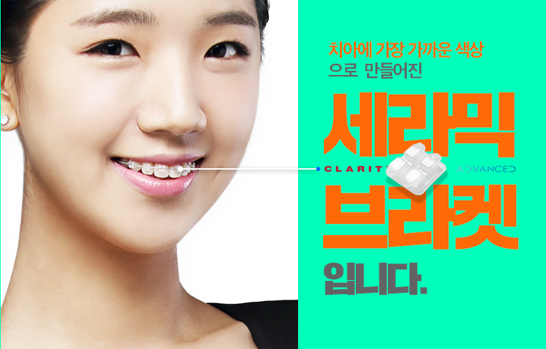 미국3M치아교정 클래러티 어드밴스 세라믹치과 관련 이미지 5