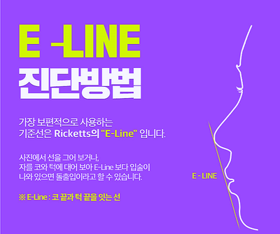 강남교정치과 관련 이미지 8