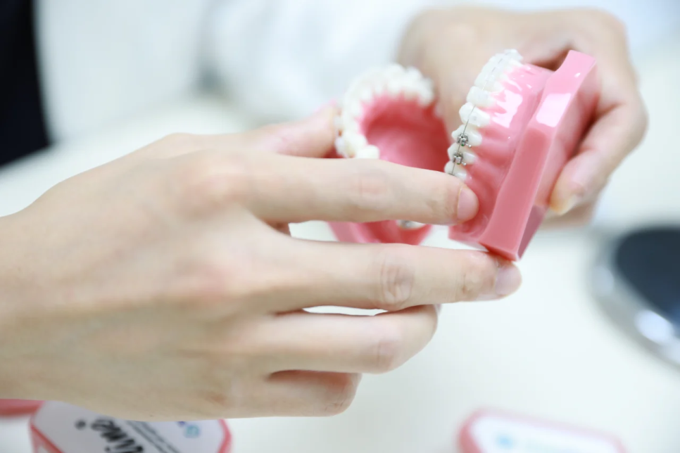 Gangnam Orthodontic Treatment: Differences by Treatment Method and How to Choose the Right Option for You image 2
