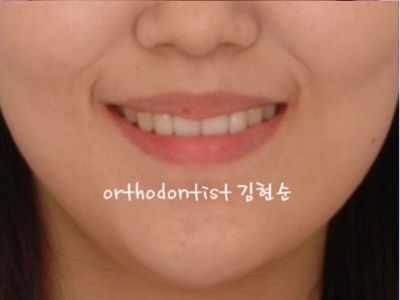 강남교정치과 관련 이미지 37
