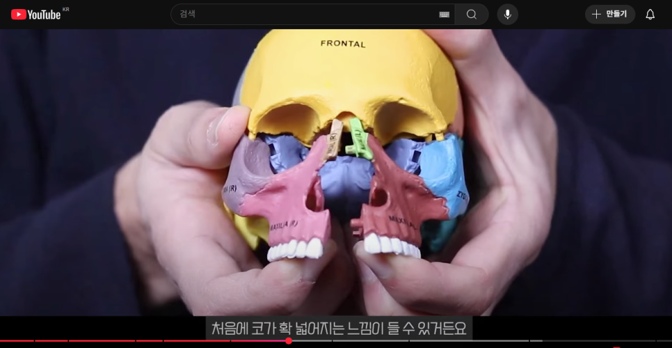 강남치아교정, 악궁확장하면 얼굴크기 커질까? 관련 이미지 6