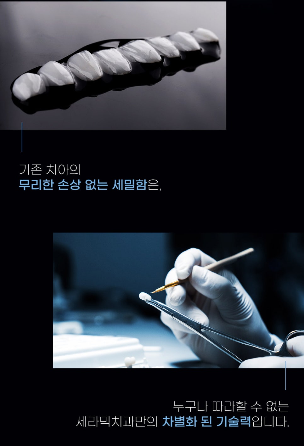 치아교정과 라미네이트는 선택이 아닌 상호 보완관계! 관련 이미지 5