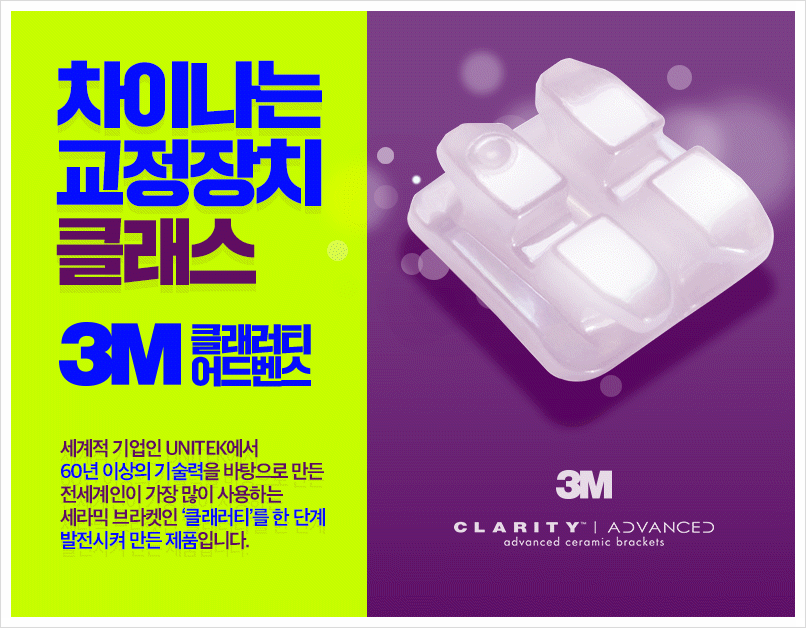 세라믹교정 단점을 보안한 클래러티 어드밴스 ~ 관련 이미지 5