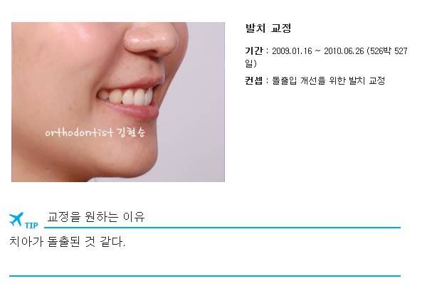 돌출입발치 교정증례 관련 이미지 1