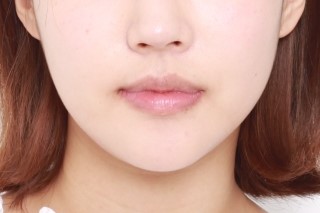 세라믹치과  교정리얼 스토리 관련 이미지 1