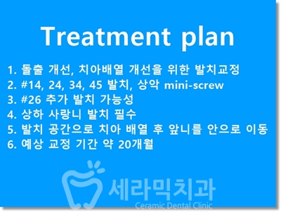 덧니와 돌출입을 한번에! 치아교정 전후사진 관련 이미지 12