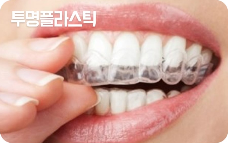 교정장치 구분하기 관련 이미지 12