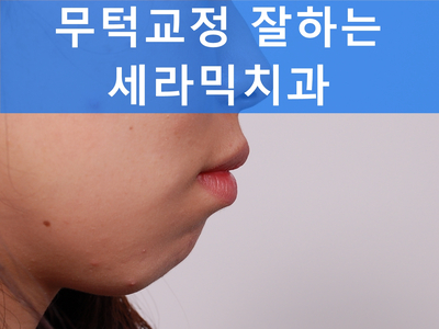 무턱교정, 거미스마일 교정 잘하는 학동역 세라믹치과 관련 이미지 1