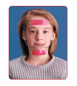 [소아교정/소아교정추천] 어린나이에 교정을 하는 이유는? 관련 이미지 3