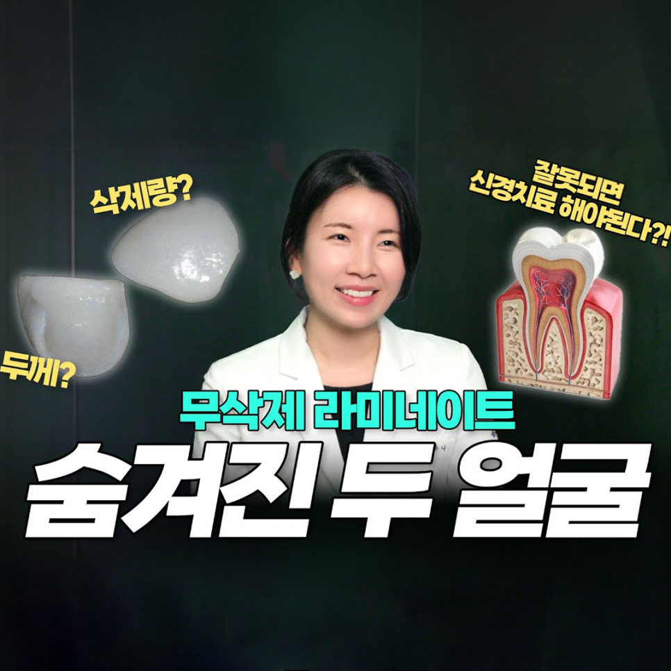 연예인 무삭제 라미네이트, 과연 안전할까? 관련 이미지 1