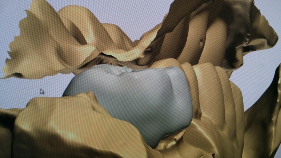 [미소가아름다운치과 양재유]  디지털 기공소 운영 관련 이미지 6