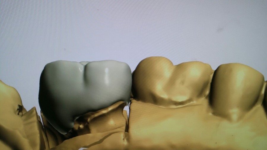 [미소가아름다운치과 양재유]  디지털 기공소 운영 관련 이미지 9