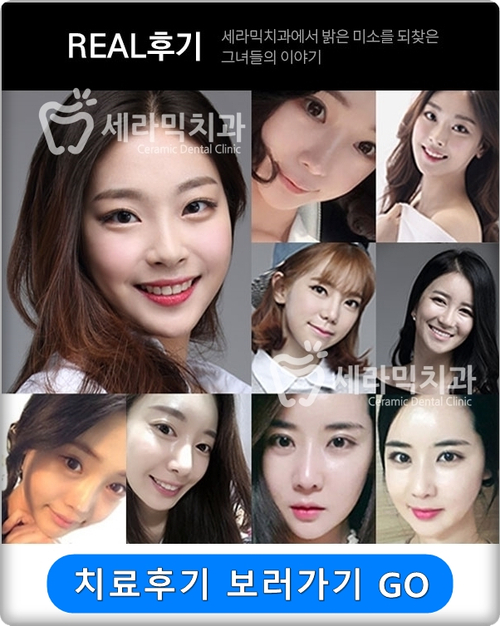 돌출입 세라믹교정으로 자신감 up! 세련미 완성! 관련 이미지 4