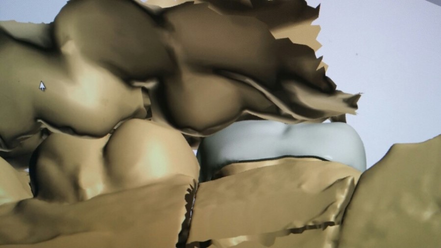 [미소가아름다운치과 양재유]  디지털 기공소 운영 관련 이미지 5