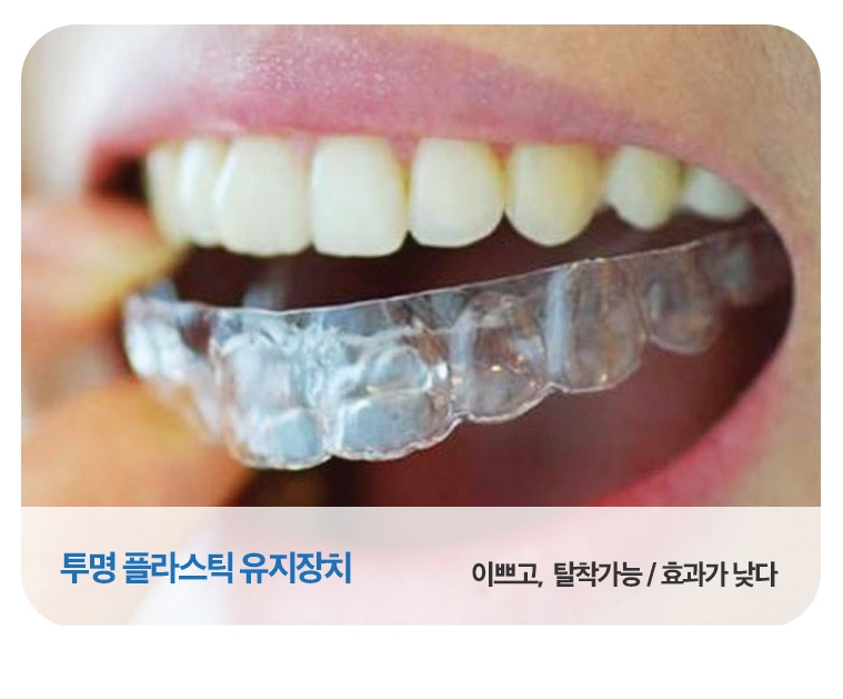 치아교정 유지장치로 부작용 예방을! 관련 이미지 5