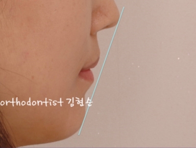 강남교정치과 관련 이미지 40