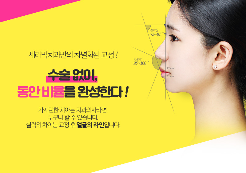 학동역치과 치아교정 세라믹치과 관련 이미지 2