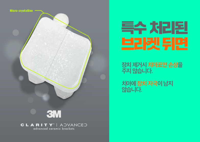 미국3M치아교정 클래러티 어드밴스 세라믹치과 관련 이미지 7