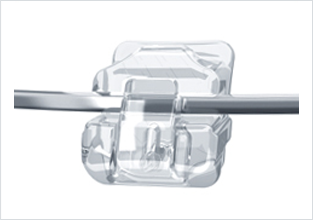 데이몬클리어 vs 클리피씨교정 관련 이미지 7