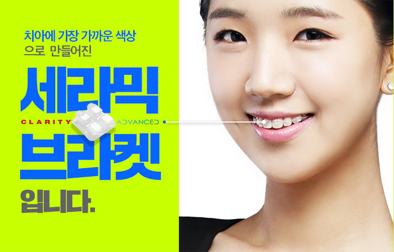 3M 클래러티 어드밴스 치아교정 이곳에서 관련 이미지 8
