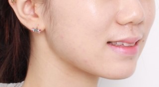 3D 스캐너를 이용한 교정 심뮬레이션 관련 이미지 4