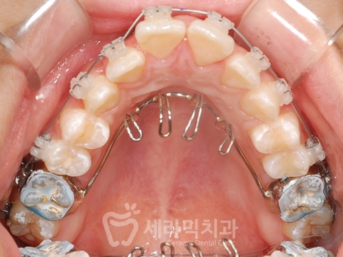 우리 아이 관련 이미지 7