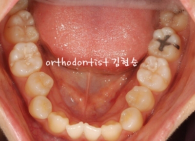강남교정치과 관련 이미지 9