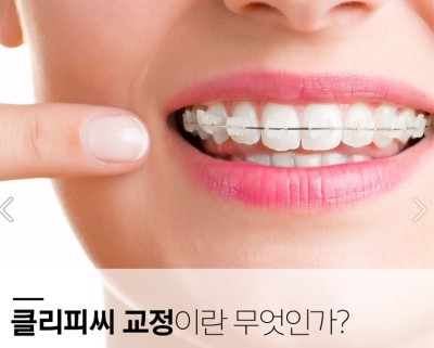 세라믹교정 세라믹치과 클리피씨교정 이야기 관련 이미지 12