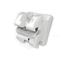 학동역치과 하면 세라믹교정 ~ 관련 이미지 8