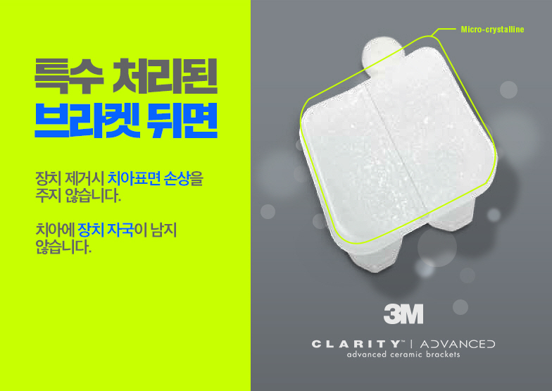 3M 클래러티 어드밴스 치아교정 이곳에서 관련 이미지 10