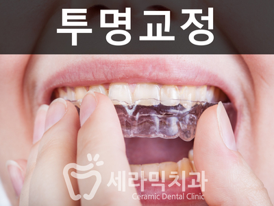 세라믹치과에서 세라믹교정이 인기있는 이유! 관련 이미지 3