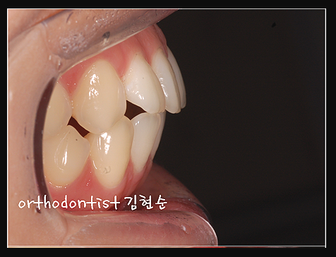 강남교정치과 관련 이미지 29
