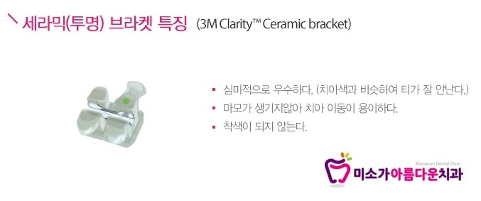 강남교정전문치과 미소가아름다운치과의 세라믹교정 [세라믹교정,강남세라믹교정,미소가아름다운치과] 관련 이미지 4