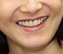 학동역치과 치아교정은 여기서 !! 관련 이미지 7