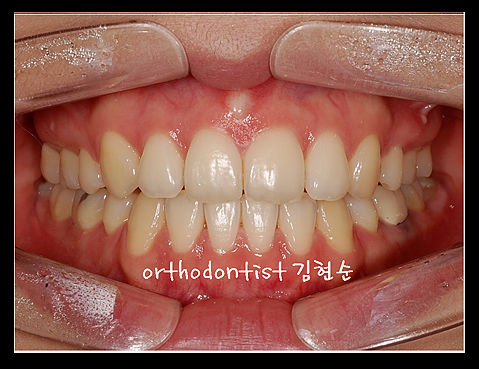 강남교정치과 관련 이미지 28