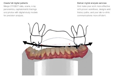 세라믹교정 세라믹치과 - 아나운서 교정이 뭘까요 ? 관련 이미지 6