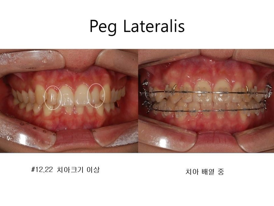 학동역치과 치아교정 잘하는 곳 ! 관련 이미지 33