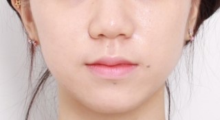 3D 스캐너를 이용한 교정 심뮬레이션 관련 이미지 1