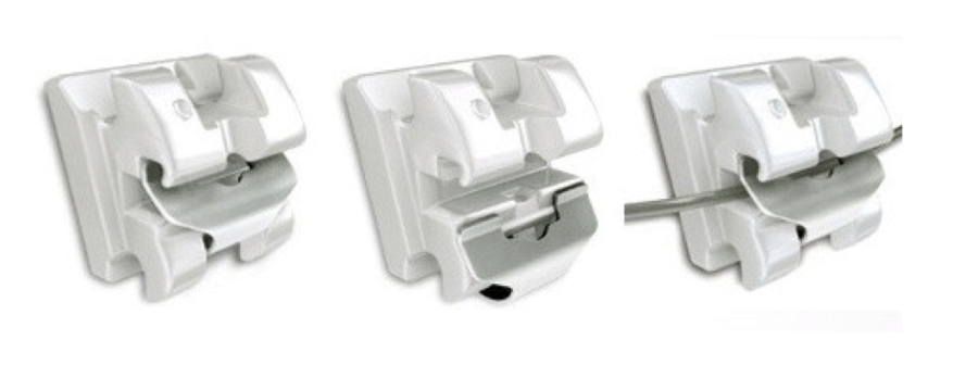 클리피씨 비용 기간단축 관련 이미지 8