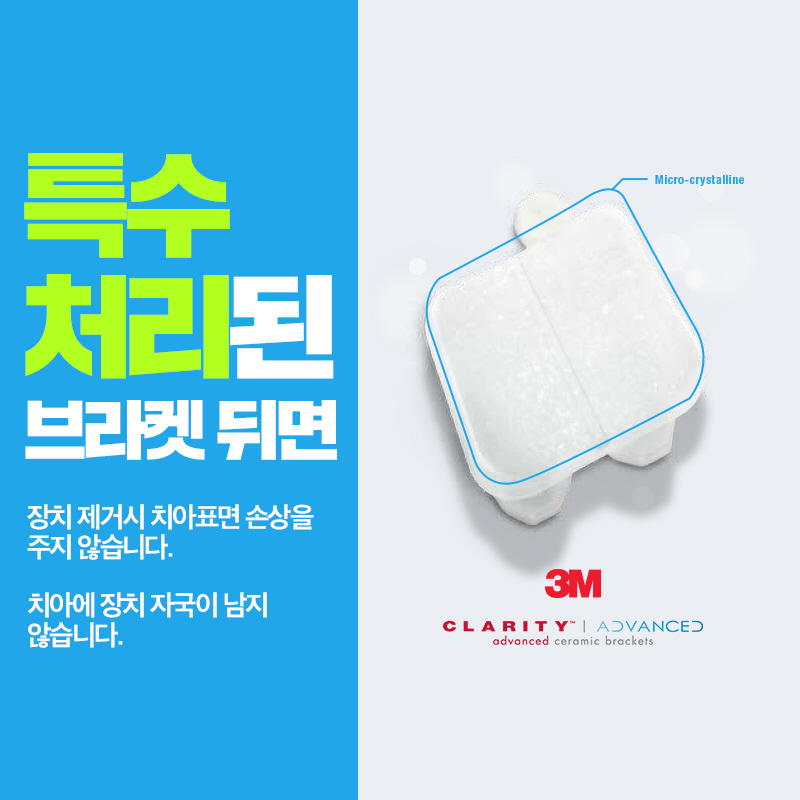 학동역 치아교정 3M 클래러티 어드밴스 관련 이미지 8