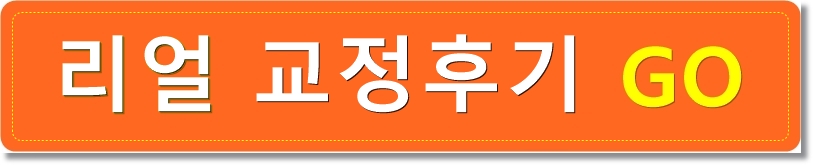 과개교합 비발치 치아교정전후 비교 관련 이미지 3