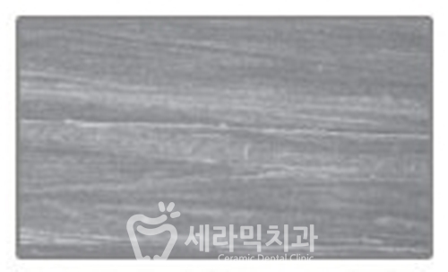 교정기 세정 세척제, 거품치약, 티드클린얼라인 관련 이미지 3