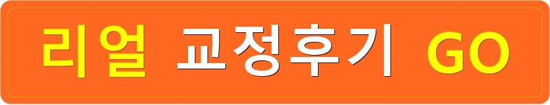 치아교정전후. 돌출입교정으로 갸름한 입술을 얻다! 관련 이미지 4