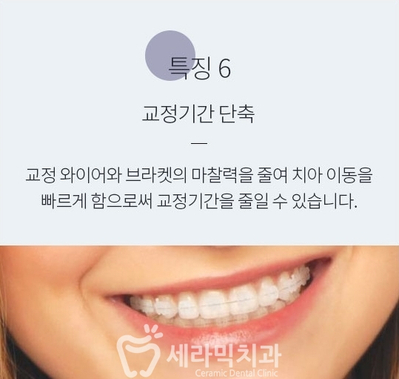 세라믹치과에서 세라믹교정이 인기있는 이유! 관련 이미지 11