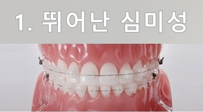 세라믹교정 잘하는 곳은? 세라믹치과 관련 이미지 12