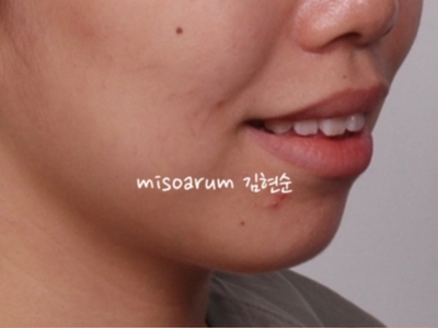 강남치아교정추천 관련 이미지 38