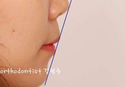 강남 돌출 관련 이미지 31