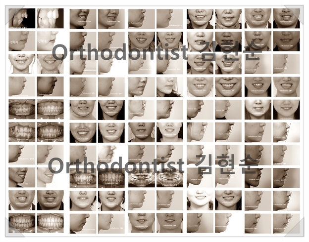 학동역 세라믹치과, 치아교정 치과 선택 가이드 관련 이미지 3
